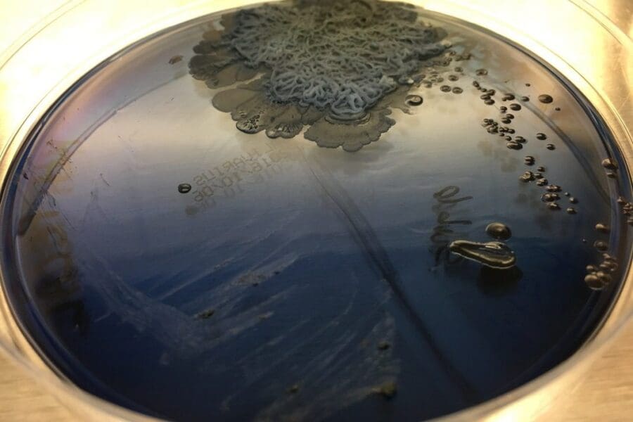 Agar plate and fecal bacteria