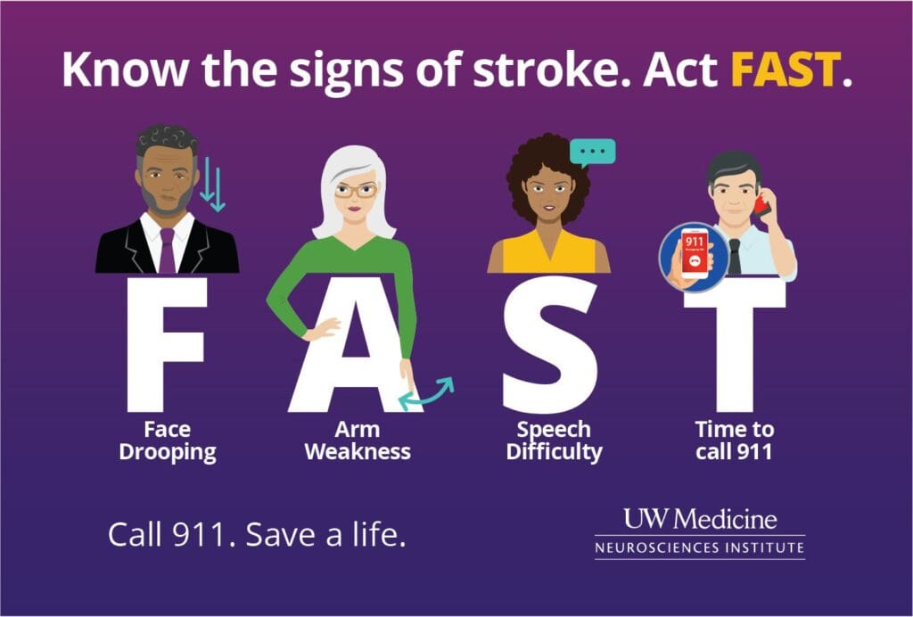 Signs of Stroke Graphic